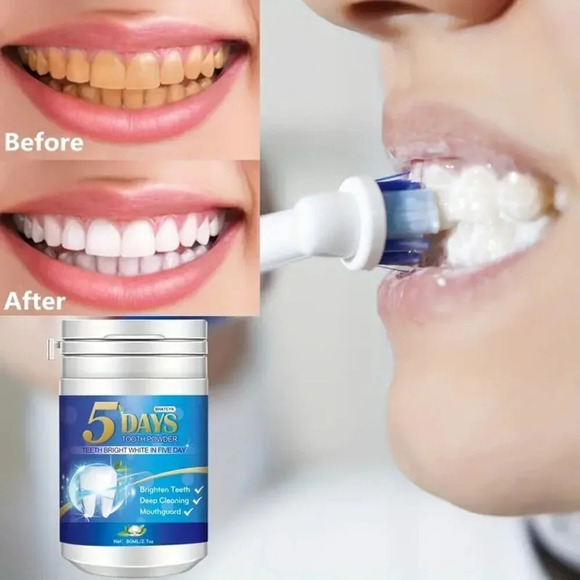 Teeth Polishing Deep Cleaning Powder - Picture 2 of 8